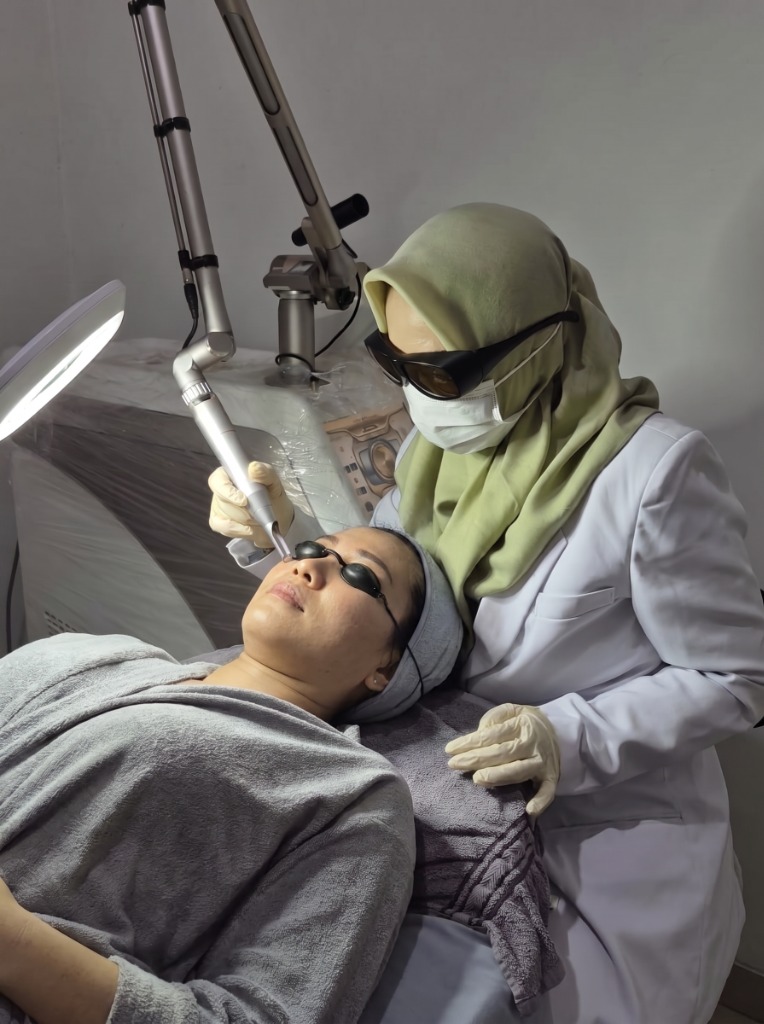 Prosedur Pico Laser oleh dr. Nunik Sriwahyuni, Sp.DVE